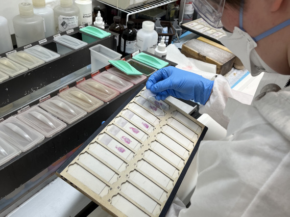 Person holding histology slides