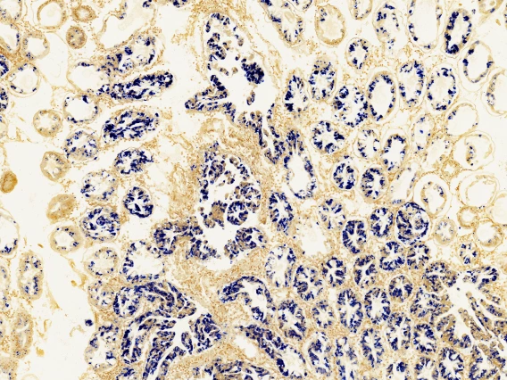 In-situ hybridization image